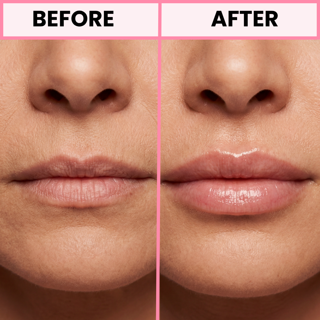 Peptide Lip Plumper